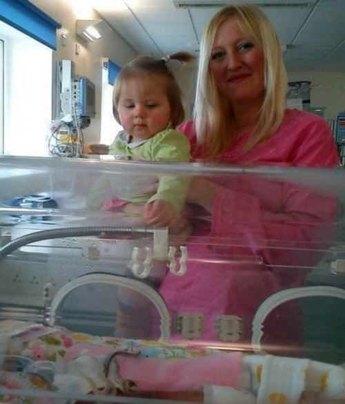 24-недельная новорожденная девочка выжила!