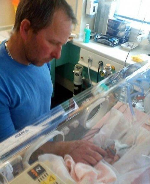 24-недельная новорожденная девочка выжила!