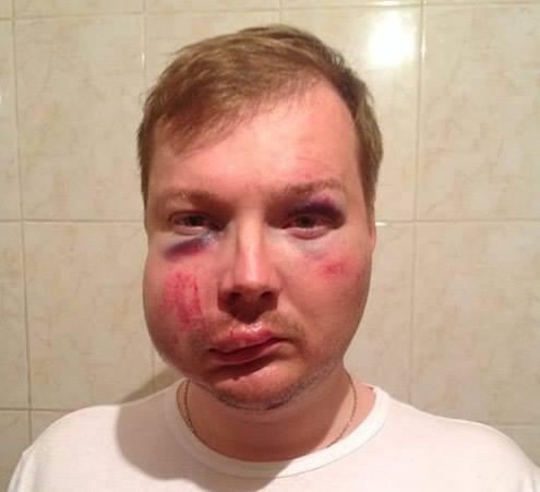 Міліція жорстоко побила активістів, які їхали в Харків