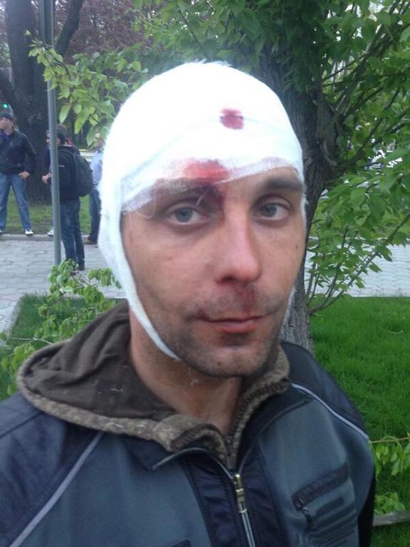 Во время столкновений в Донецке разбили голову журналисту