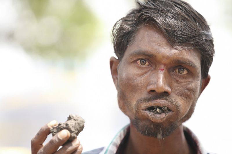Индиец 20 лет питается кирпичами и камнями