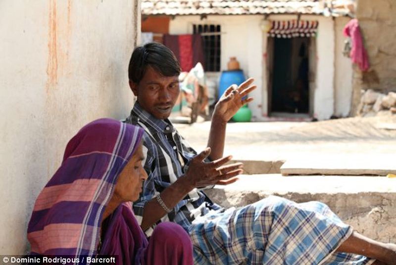 Індієць 20 років харчується цеглою і камінням