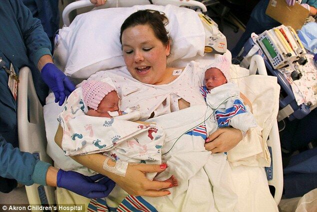 Редкие близняшки родились, держась за руки. Уникальные фото