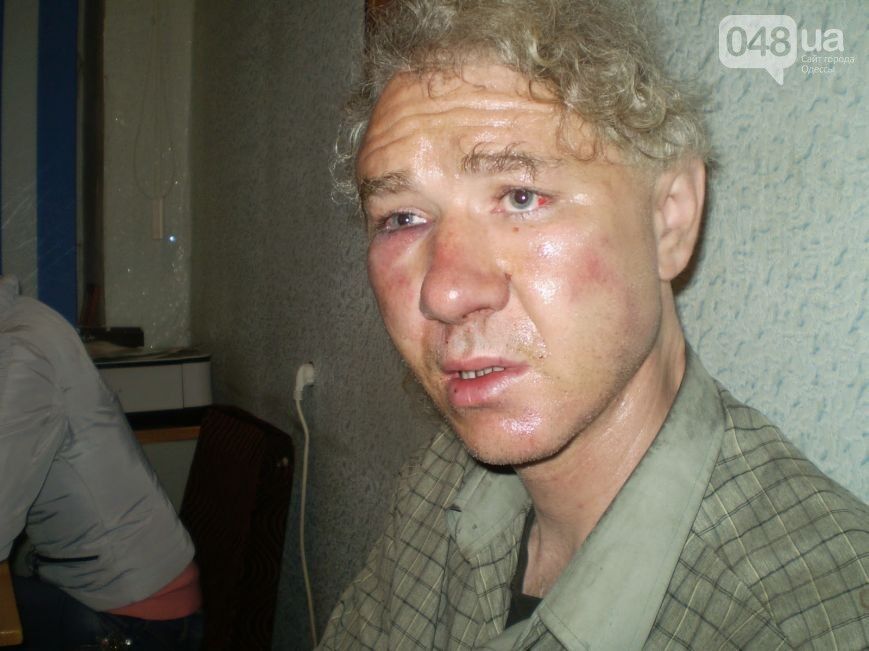 Боевики избили одесского журналиста и сожгли его квартиру за то, что он "не любит Путина"