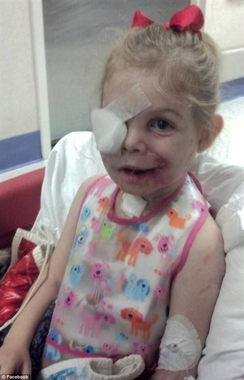 3-летнюю девочку, изуродованную питбулями, выгнали из KFC, из-за внешности