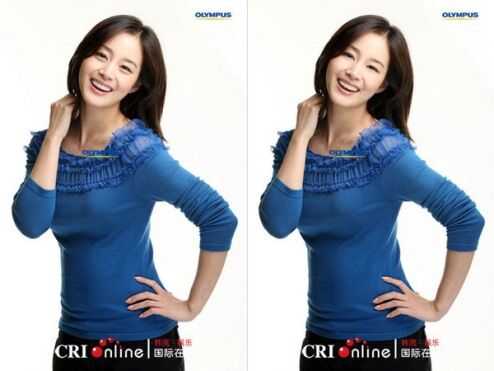 Мешки под глазами — новая модная тенденция в Корее