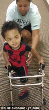 Видео с малышом, который старается сделать первые шаги на протезах, растрогало тысячи людей