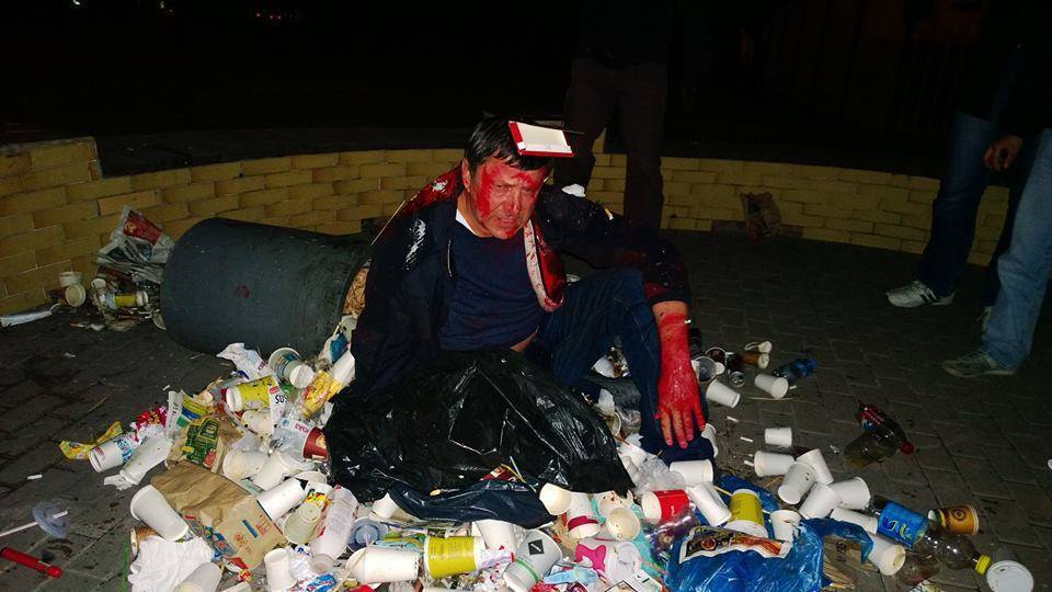 Нардепа Пилипишина бросили в мусор и облили краской: опубликовано фото