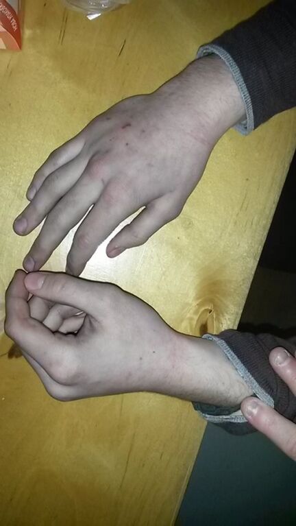 Столичная милиция открестилась от пыток 17-летнего активиста: фото "потерпевшего"