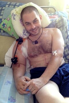 Хирурги института Шалимова спасли руку бойцу ''Азова''