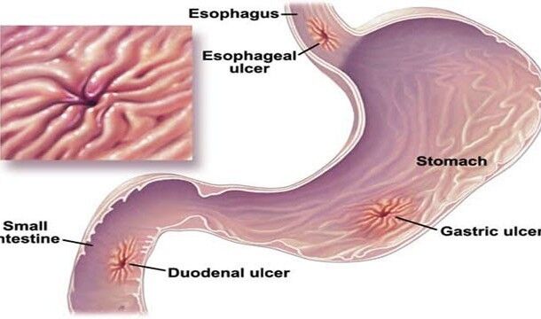 Мировые тайны, которые все же удалось раскрыть