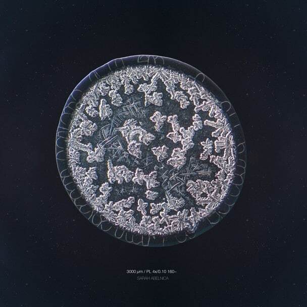Голландский фотограф снял слезы под микроскопом: завораживающие фото