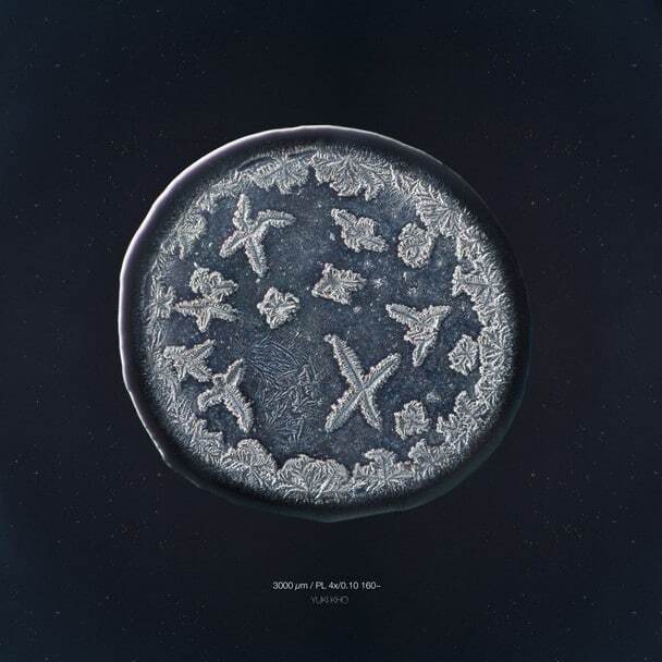 Голландський фотограф сфотографував сльози під мікроскопом: чарівні фото