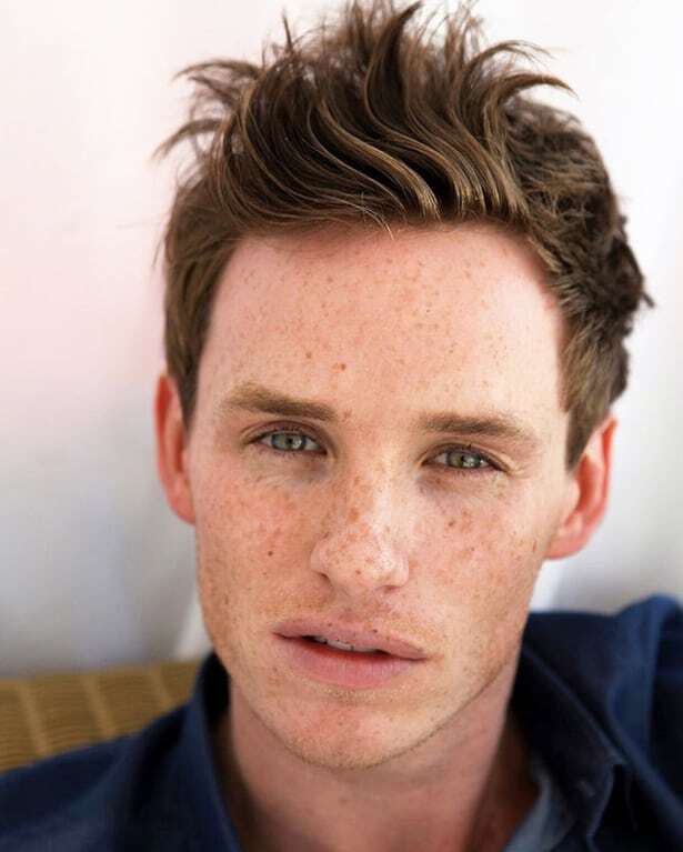 Поцелуй солнца: самые красивые звезды с веснушками