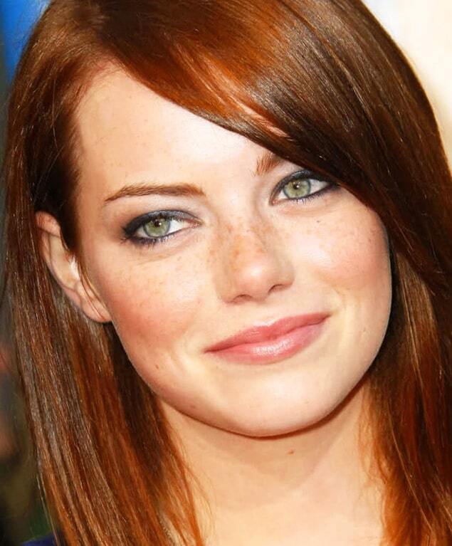 Поцелуй солнца: самые красивые звезды с веснушками