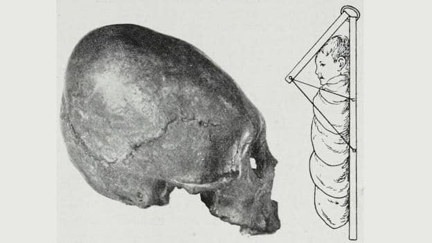 Ученые выяснили, зачем древние люди меняли вид своих черепов