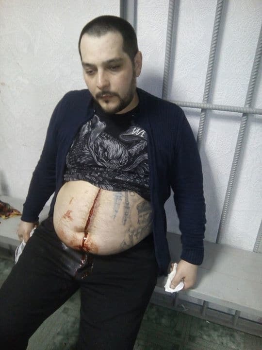 В Киеве задержанные в суде порезали себе вены и вспороли живот: опубликованы фото и видео