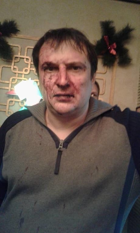 У Дніпропетровську міліціонер з "дружками" побили двох чоловіків: розповідь потерпілого