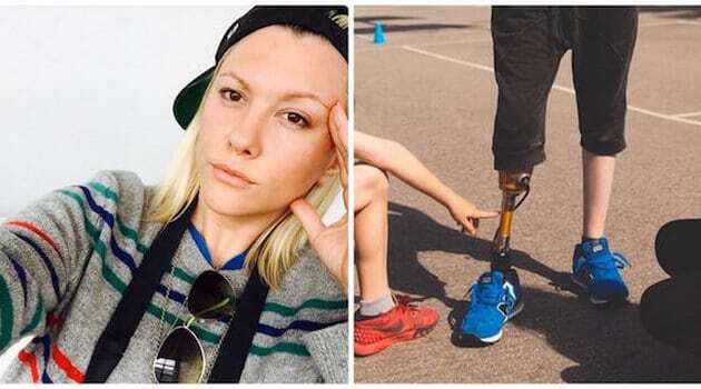 24-річна модель стала інвалідом через використання тампонів