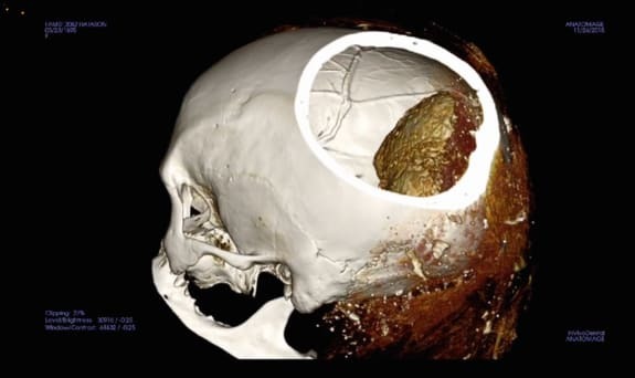 Ученые обнаружили необычную мумию из Египта, ставящую науку в тупик