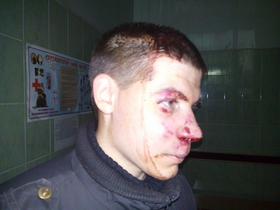Одесситы поймали террориста из России - одного из трех избивших добровольца полка "Азов"