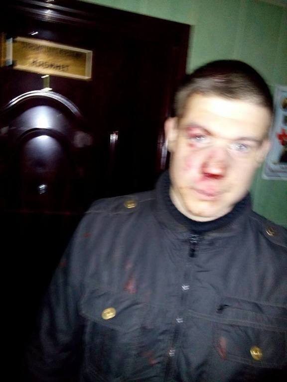 Одесситы поймали террориста из России - одного из трех избивших добровольца полка "Азов"