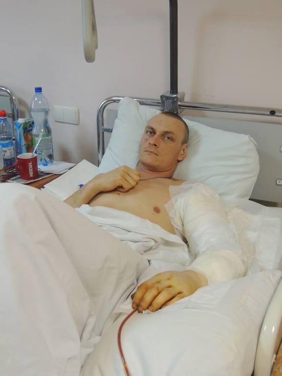 "Киборгу", которого допрашивал LifeNews, грозит ампутация руки: нужна помощь