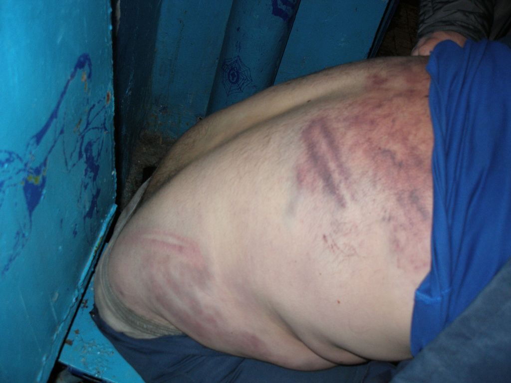 В Одесском СИЗО жестоко пытают людей: опубликованы фото