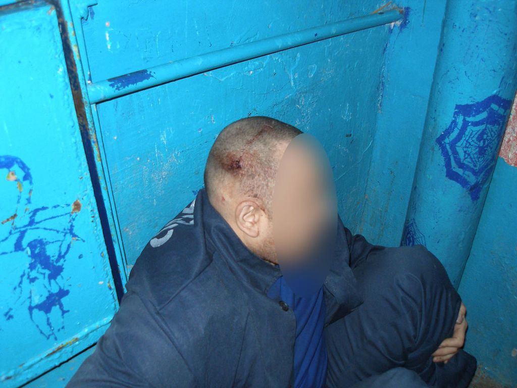 В Одеському СІЗО жорстоко катують людей: опубліковано фото