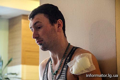Удачная и плановая операция: боец рассказал, как раненый выходил из Дебальцево 5 дней по полям