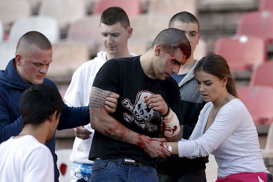 В Сербии фанаты устроили кровавое побоище с полицией: жуткие кадры