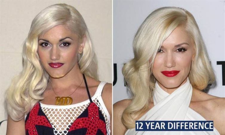 22 знаменитости, внешность которых не меняется десятилетиями