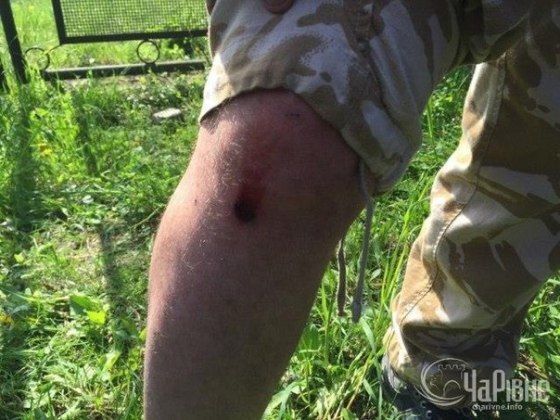 В Ривненской области охранники фирмы расстреляли волонтеров: фотофакт
