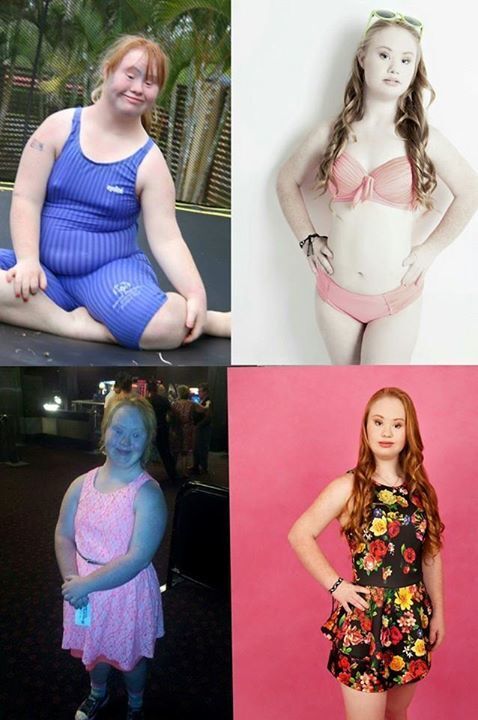 Невероятное перевоплощение: девушка с синдромом Дауна стала красавицей-моделью 