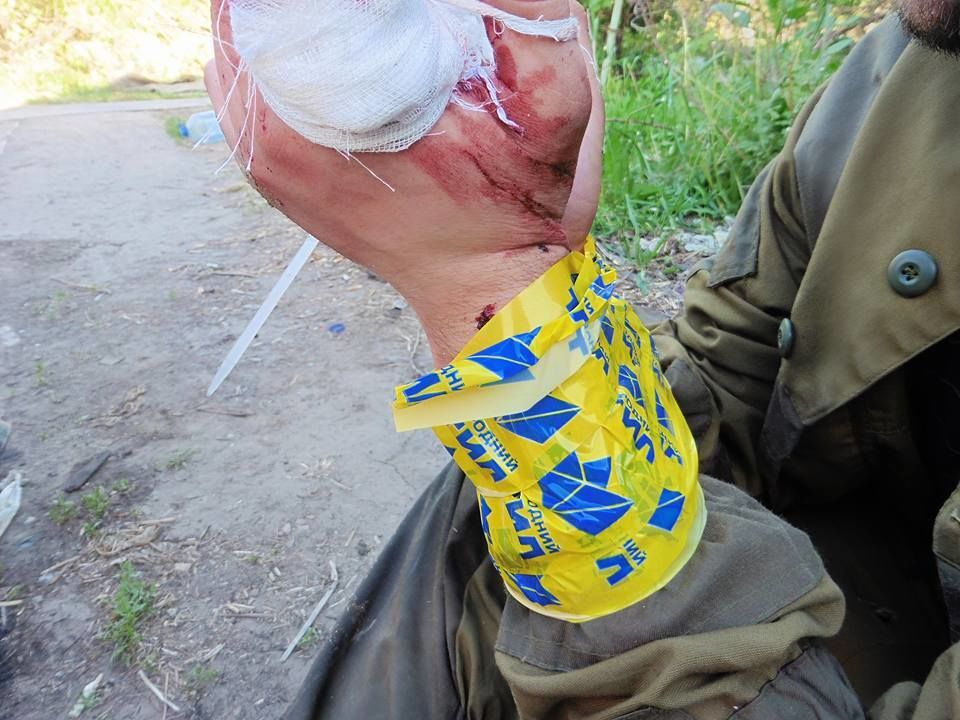 Под Донецком поймали террориста в форме от Путина: фотофакт