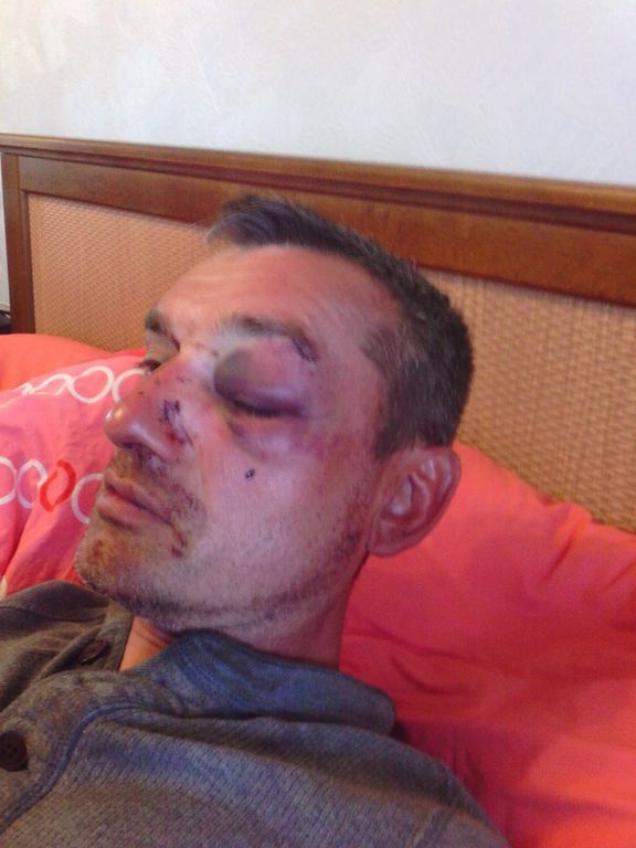 Выдворенный из Украины Ташбаев заявил, что его жестоко избили
