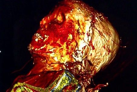 Французы нашли мумию миледи