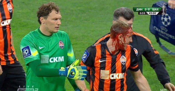 Футболисту "Шахтера" разбили голову в финале Кубка Украины: кровавые фото