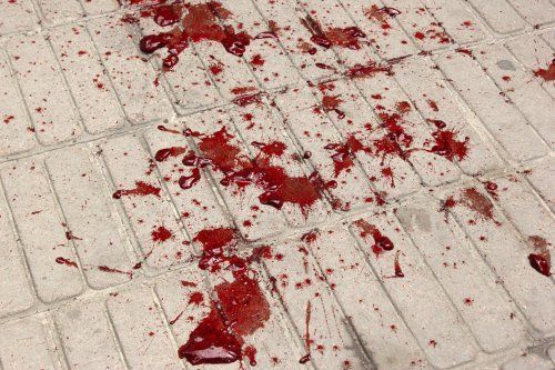 Во Львове нардепа из "Оппозиционного блока" облили свиной кровью: опубликованы фото и видео