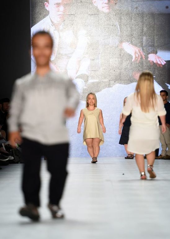 На уровне глаз: мировой подиум покоряют модели-карлики. Фотофакт