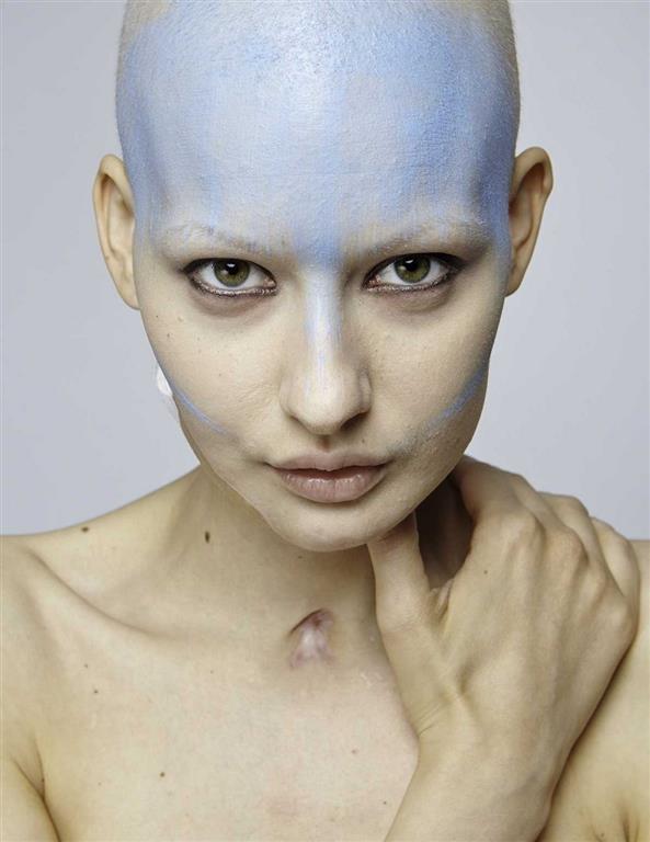 Потрясающие снимки модели, которая потеряла челюсть из-за рака