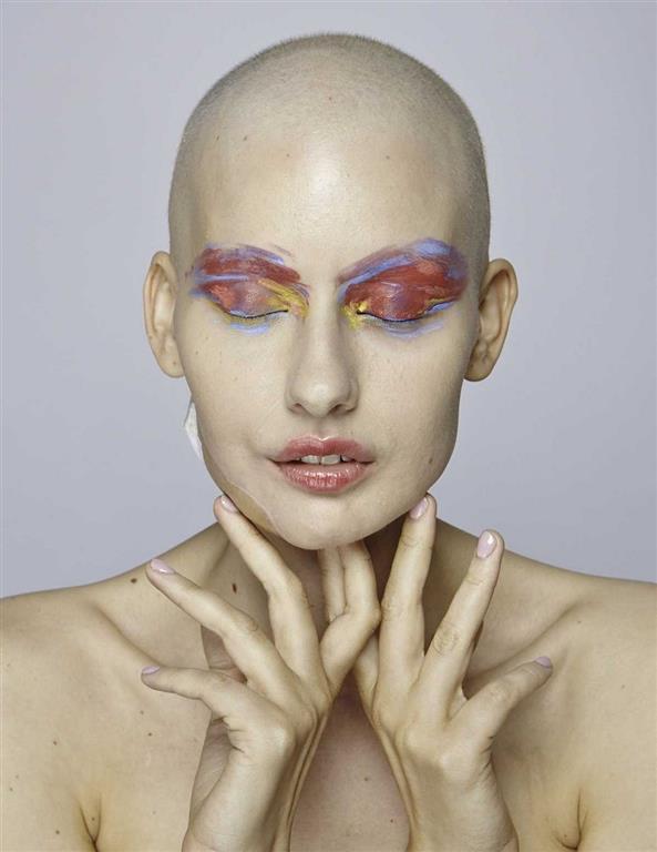 Потрясающие снимки модели, которая потеряла челюсть из-за рака