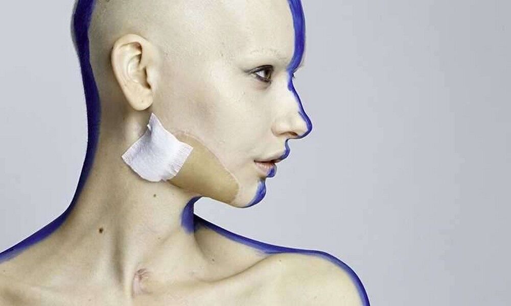 Потрясающие снимки модели, которая потеряла челюсть из-за рака