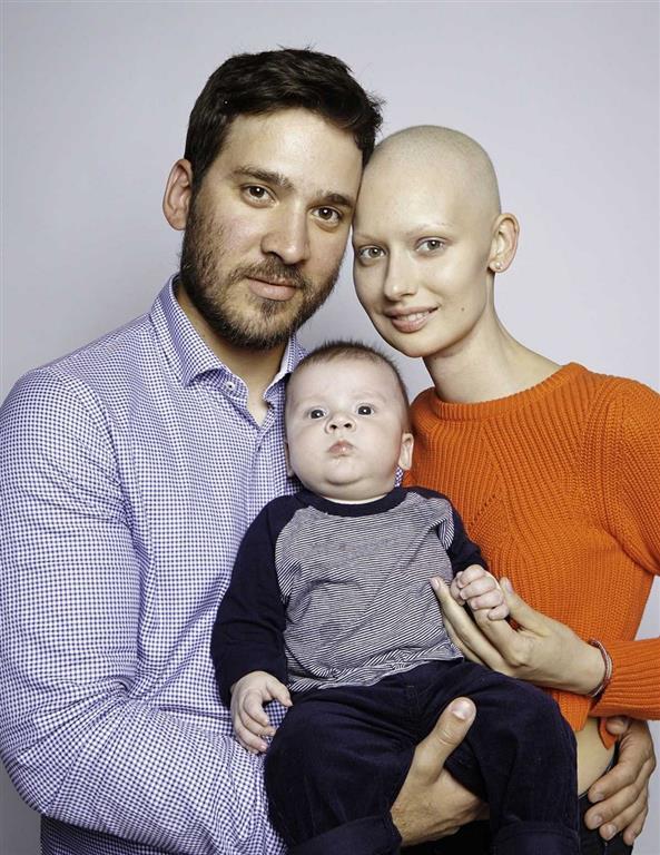 Потрясающие снимки модели, которая потеряла челюсть из-за рака