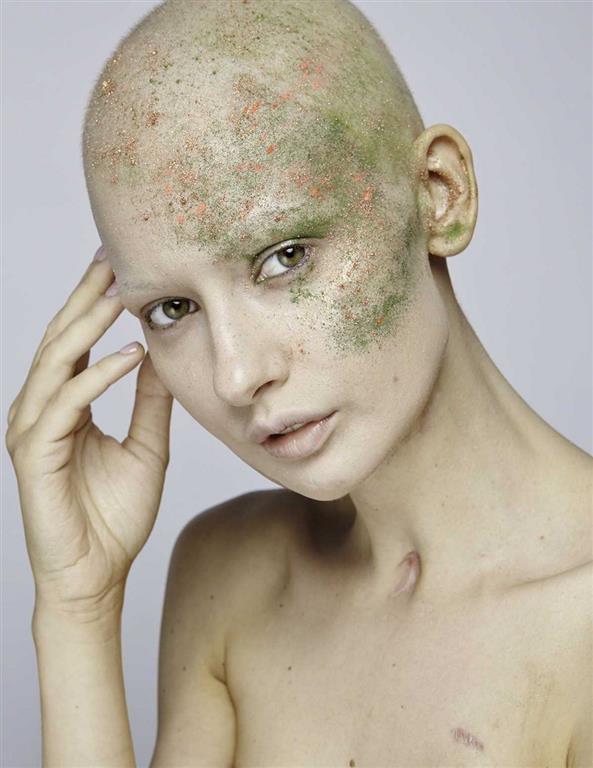 Потрясающие снимки модели, которая потеряла челюсть из-за рака