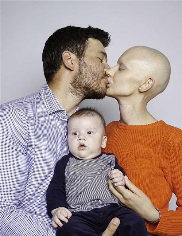 Потрясающие снимки модели, которая потеряла челюсть из-за рака