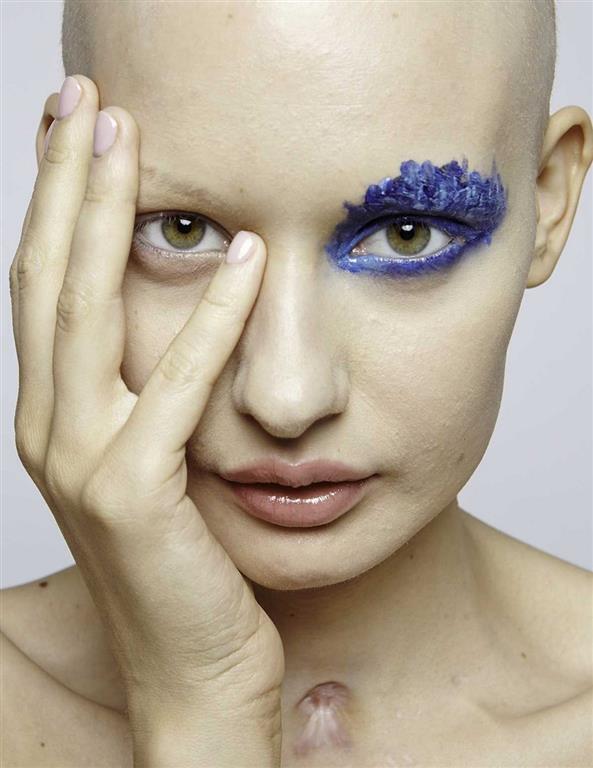 Потрясающие снимки модели, которая потеряла челюсть из-за рака