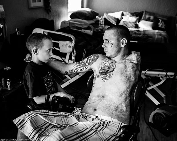 "Неизвестный солдат": пронзительные фото искалеченных в войнах американских бойцов