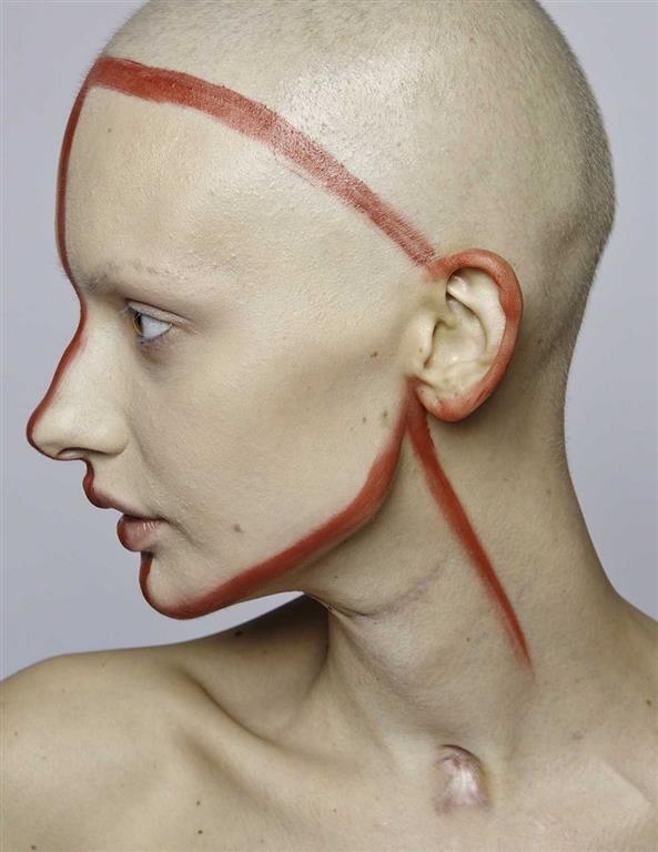 Потрясающие снимки модели, которая потеряла челюсть из-за рака