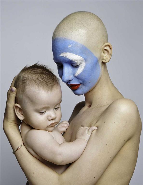 Потрясающие снимки модели, которая потеряла челюсть из-за рака